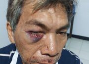 Laporan Dugaan Penganiayaan di Desa Tulap, Berakhir di Pihak Kepolisian