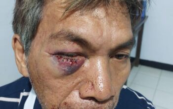 Laporan Dugaan Penganiayaan di Desa Tulap, Berakhir di Pihak Kepolisian