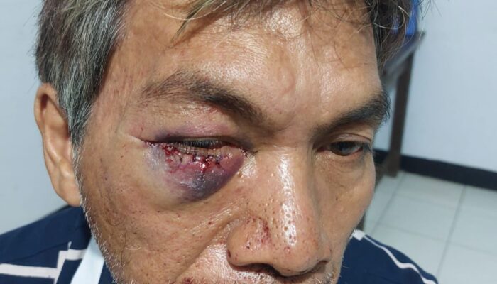 Laporan Dugaan Penganiayaan di Desa Tulap, Berakhir di Pihak Kepolisian